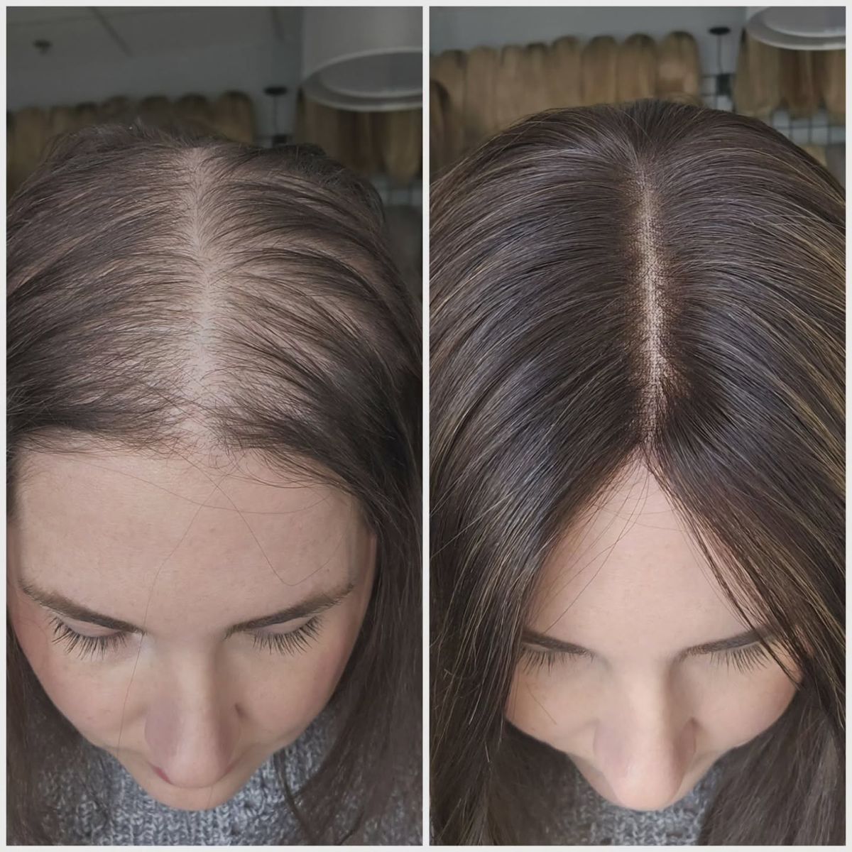 Hair Topper Result