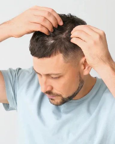 Hair Patch Transformation