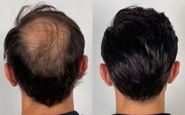 Hair Wig Transformation