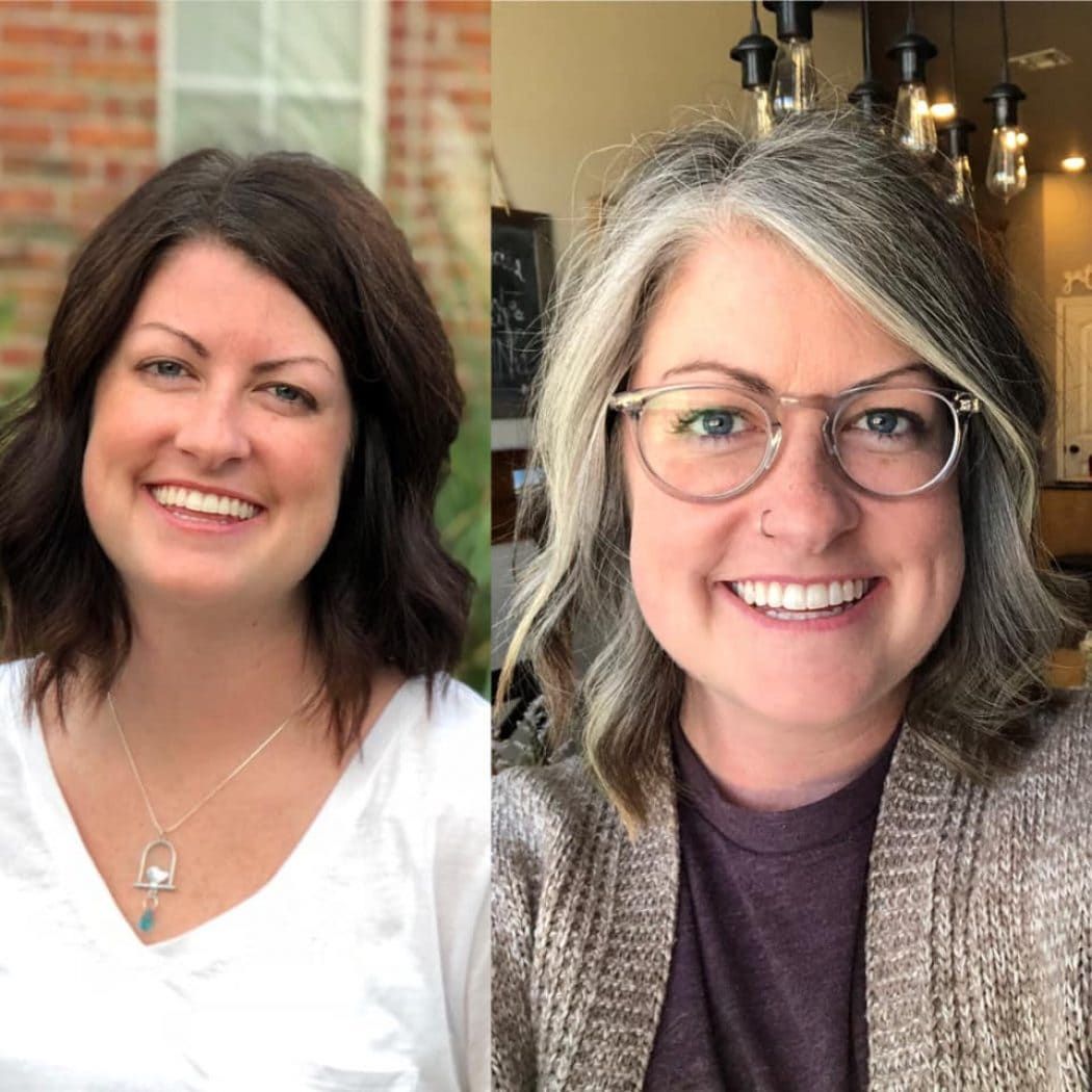 Women's Hair Patch Transformation